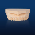 Lithium Disilicate Crown IPS Emax